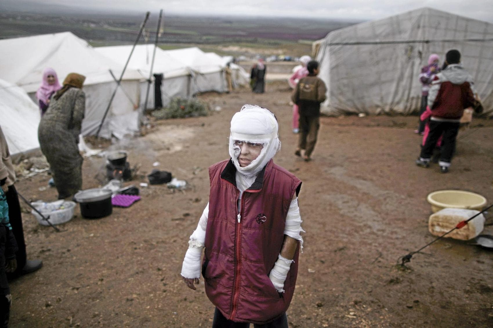 Abdullah Ahmed, 10, who suffered burns in a Syrian government airstrike and fled his home with his family, stands outside their tent at a camp for displaced Syrians in the village of Atmeh, Syria, Dec. 11, 2012. (Muhammed Muheisen, Associated Press - December 11, 2012)
